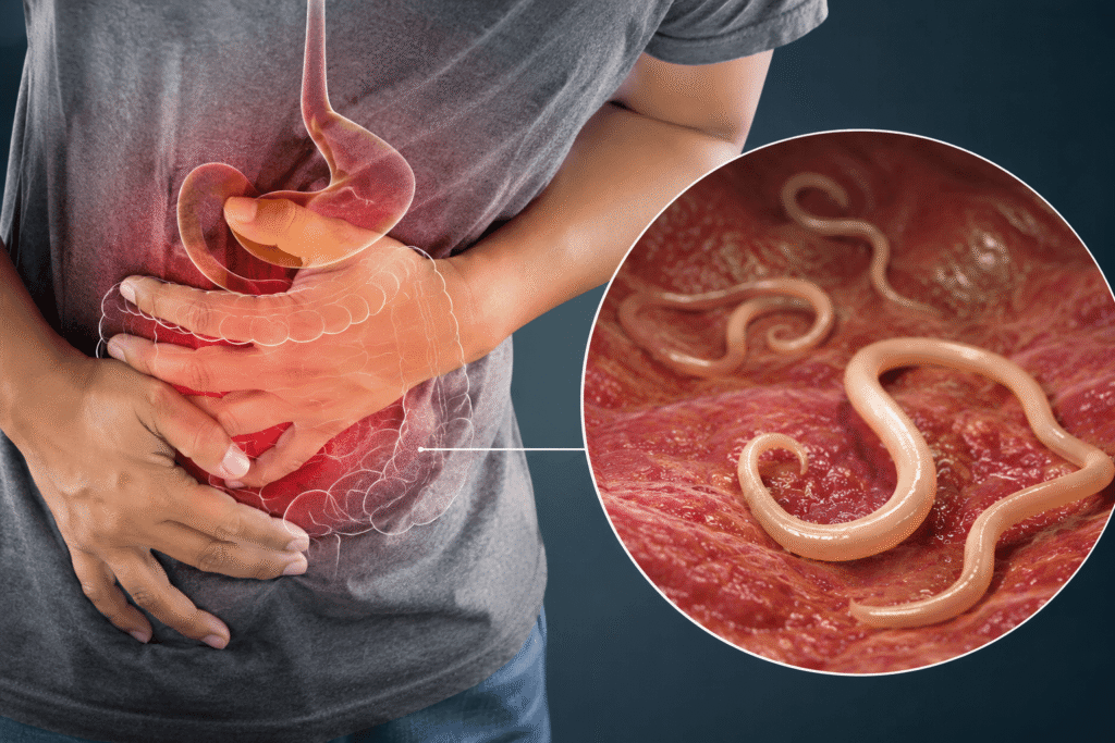 Vermes Intestinais: Causas, Sintomas e Tratamentos Eficazes