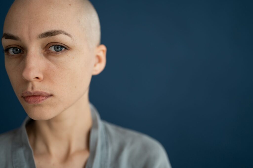 Alopecia: Entenda as Causas, Sintomas e Tratamentos