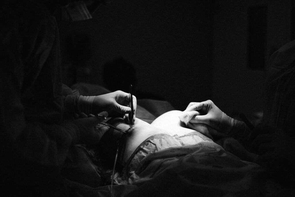 Faloplastia: Tudo que Você Precisa Saber sobre o Procedimento