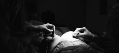 faloplastia faloplastia