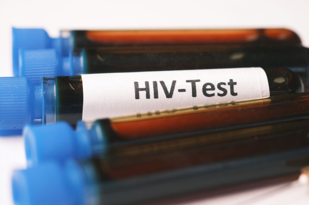HIV: Entendendo o Vírus, Sintomas e Tratamentos
