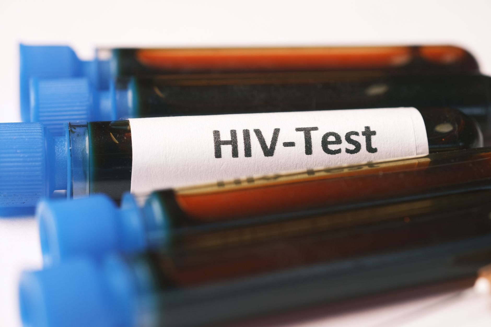 hiv hiv