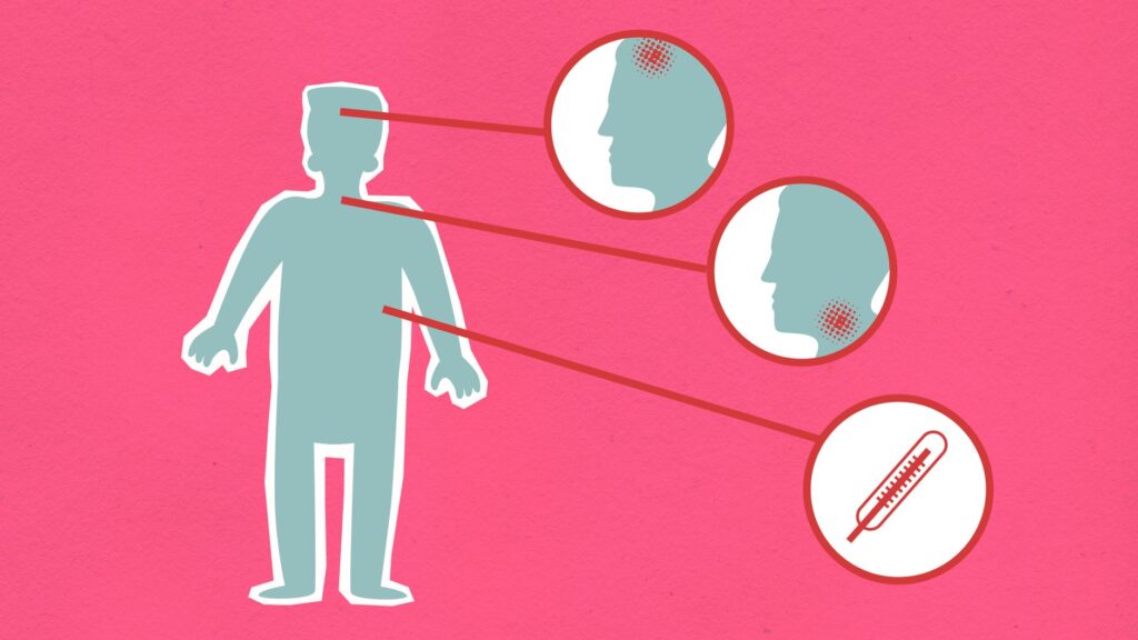 Meningite: Sintomas, Causas e Tratamentos