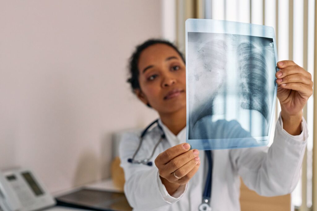 Pneumonia: Causas, Sintomas, Tratamentos e Prevenção