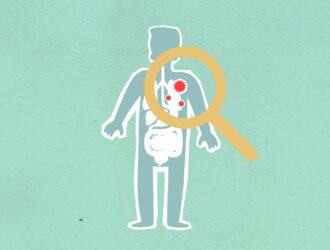 tuberculose tuberculose