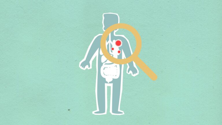 tuberculose tuberculose