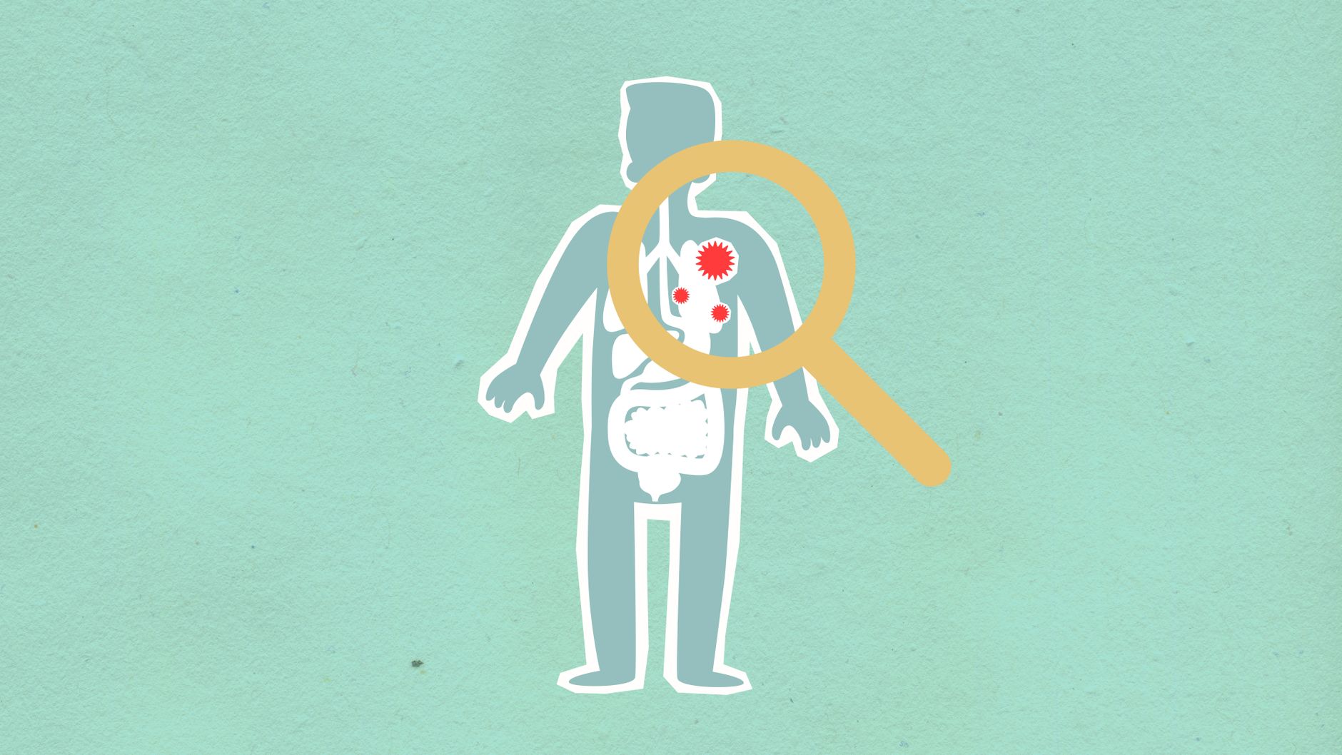 tuberculose tuberculose